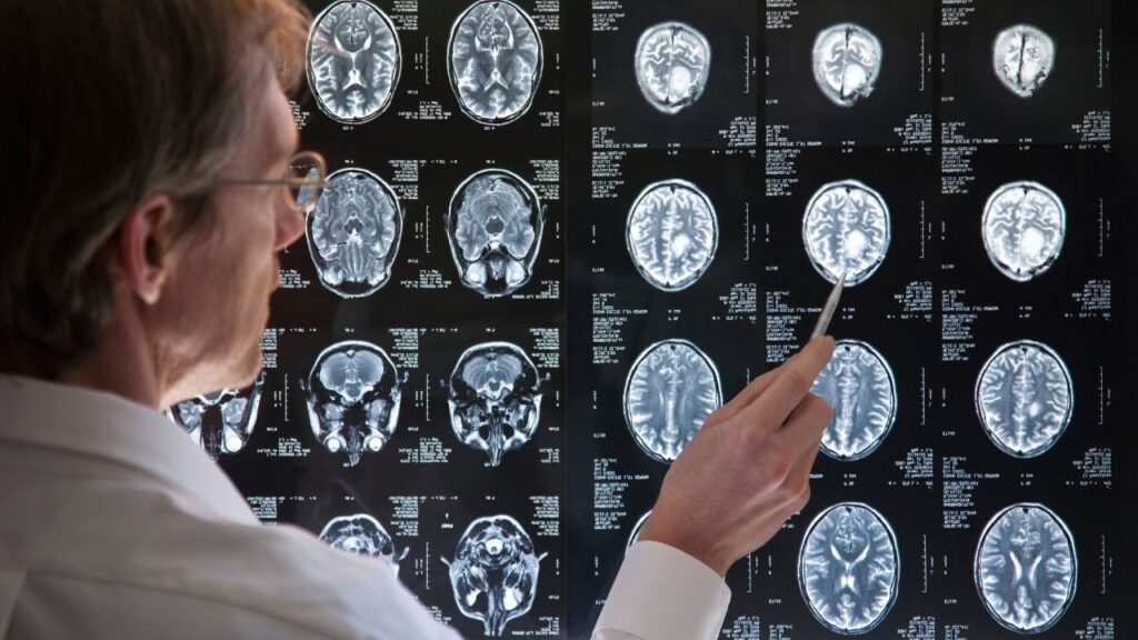 Pathophysiology of alzheimer’s disease